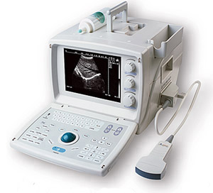 Ultrasound scanner convex portable type