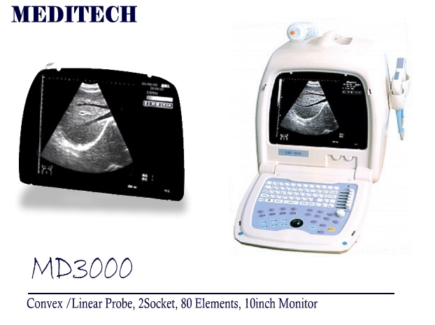 Ultrasound scanner(portable ultrasound)