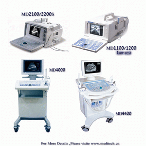 ultrasound scanner