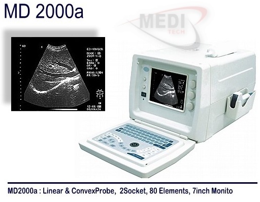 Ultrasound scanner(portable ultrasound)