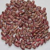 Purple Speckled Kidney beans