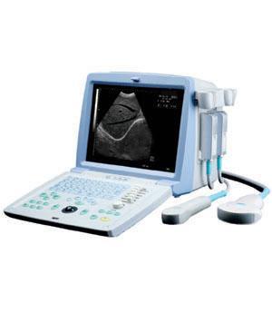 Ultrasound scanner