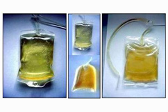  Hepatocyte Growth Factors