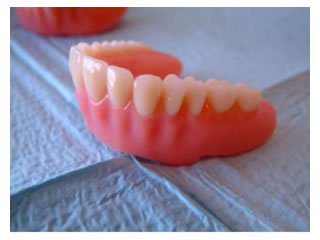 Acrylic denture