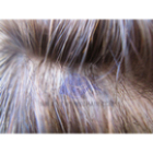 INS:Injected thin skin hair system 