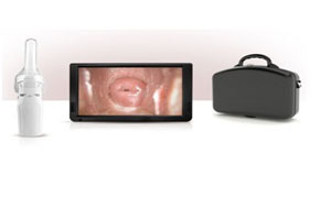 Self Exam Cervix and Vaginal colposcope (tester)