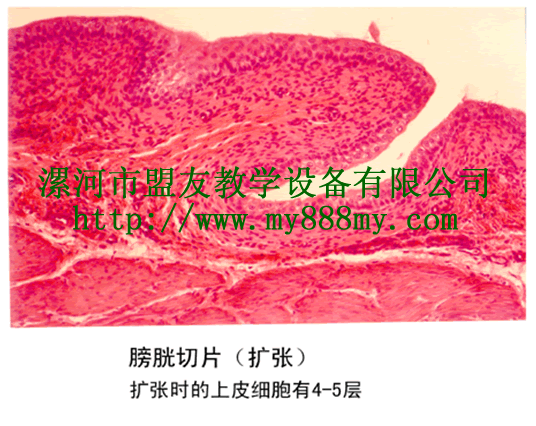 The Slice of the ectatic Bladder