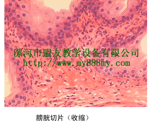 The Slice of the contractive Bladder
