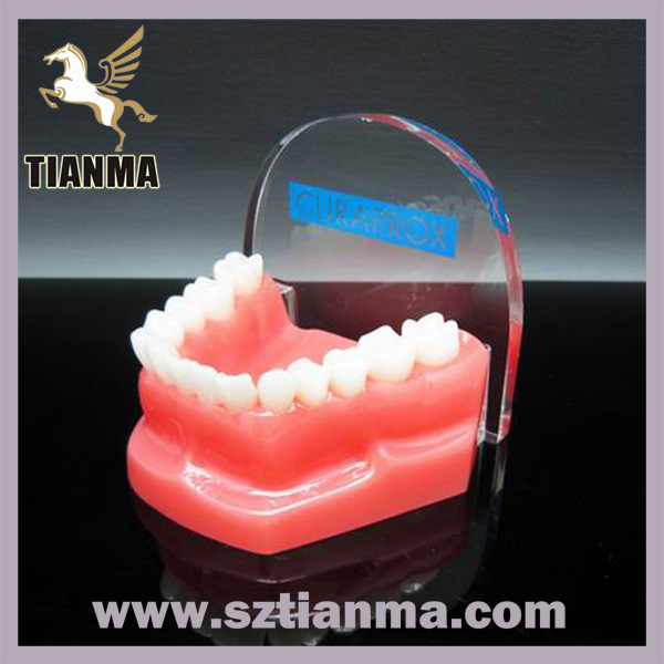 Resin Artificial Teeth Model For Advertising Gift