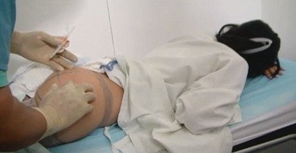 high purity hyaluronic acid gel enhance breast buttock 