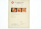8in * 10in Medical Paper Laser Printer Film KND-K For KND-DRYTEC-4000