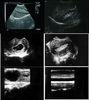 Ultrasound Scanner Bio 200C+ / CE approved medical equipment