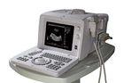 10& quot; SVGA monitor Portable Ultrasound Scanner 200C+  NEW / 64 - Frame Cinema Loop
