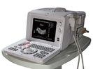3.5MHz R60 10& quot; SVGA Monitor 256 - Frame Portable Ultrasound Scanner BIO 200C+