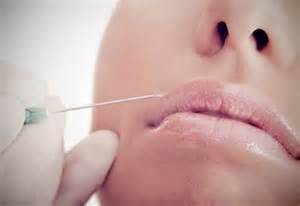 cross linked ha filler lip enhancement