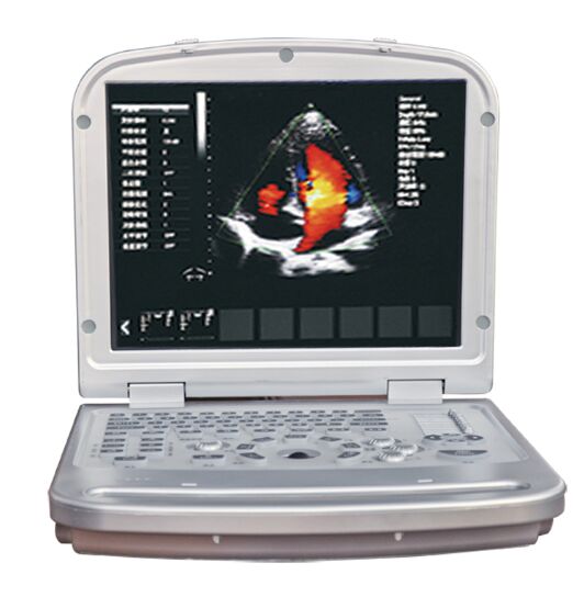 Laptop Color Doppler Medical Ultrasound Machine for Sale