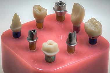 Fixed Restoration Customized Abutment