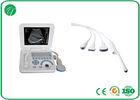 Smart Digital Colour Doppler Ultrasound CRT Stable Screen All Kinds Of Measurements