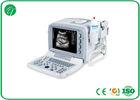 High Resolution CRT Monitor B Mode Ultrasound Scanner 10& acute;& acute; Multi - Language Ultrasonic Device