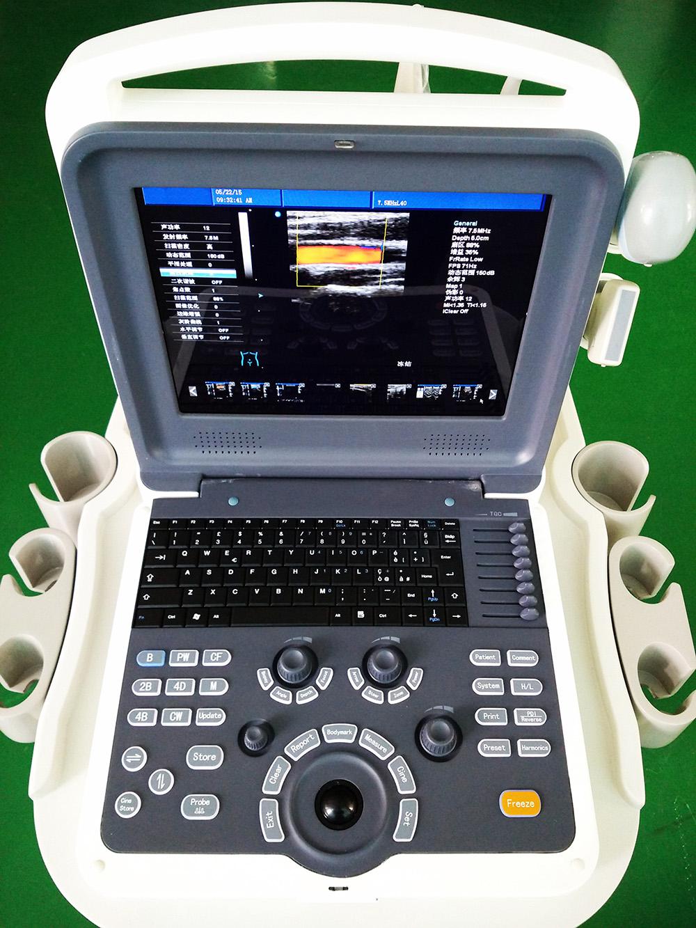 HP-Uc600p2 Portable 4D Color Doppler Ultrasound SystemHP-Uc600p2hp-uc600p2 Portable 4D Color Doppler Ultrasound System